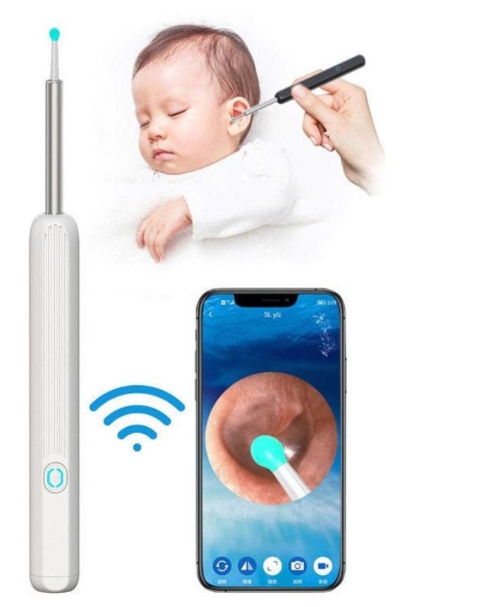 Smart Visual Earwax Removal Kit – 1080P HD Wireless Ear Ottoman Endoscope with LED Light | WiFi Ear Cleaning Camera for iOS & Android | Safe for Kids & Adults – White