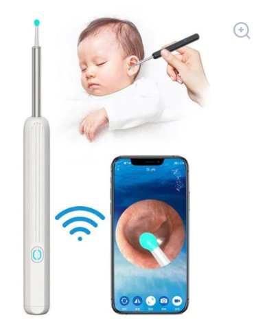 Smart Visual Earwax Removal Kit – 1080P HD Wireless Ear Ottoman Endoscope with LED Light | WiFi Ear Cleaning Camera for iOS & Android | Safe for Kids & Adults – White