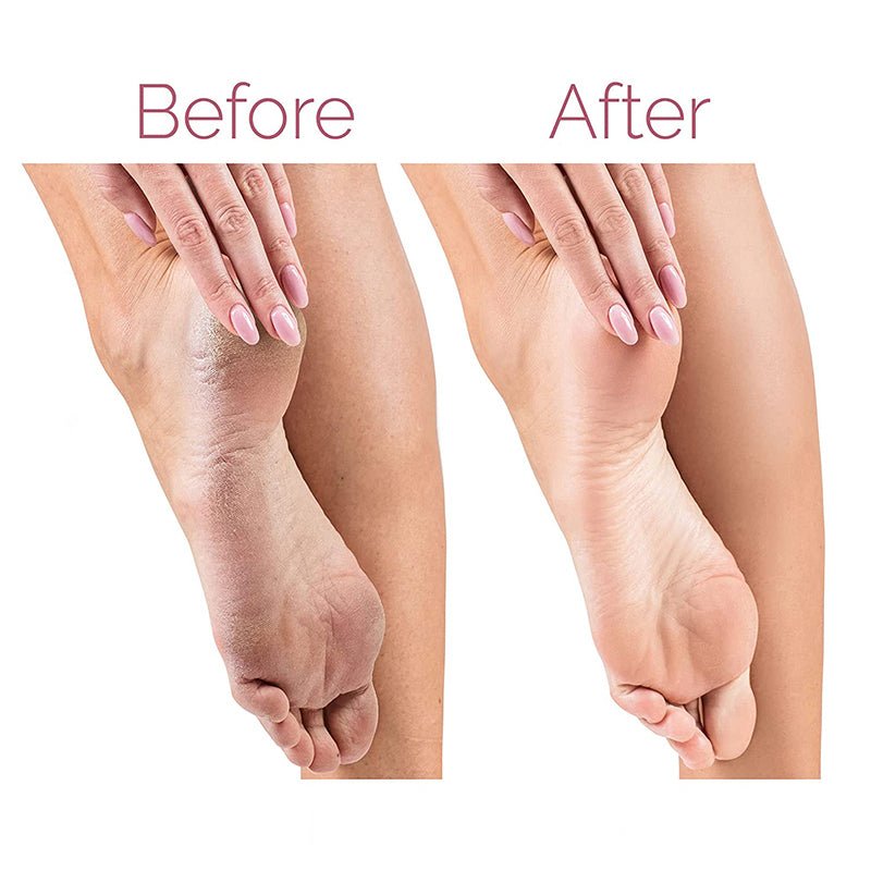 Pro-Grade Electric Pedicure Foot File & Callus Remover – Rechargeable Dead Skin Remover with 2 Speeds & 2 Roller Heads – Waterproof Spa-Quality Foot Care Tool (UAE Gold Edition)