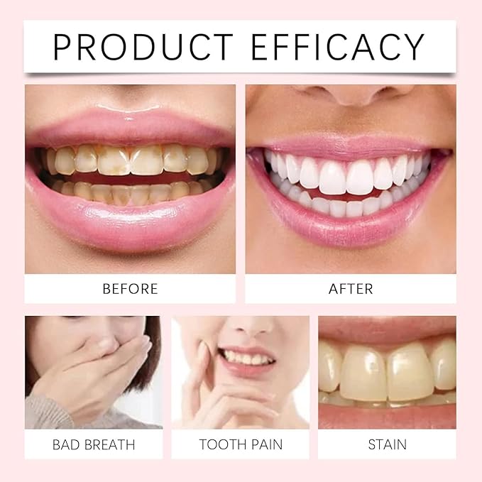 Oralhoe Nicotinamide Dazzle White Toothpaste | 100g Advanced Vitamin B3 Whitening Formula | Stain Removal, Gum Care & Fresh Breath | Sensitive Teeth Safe