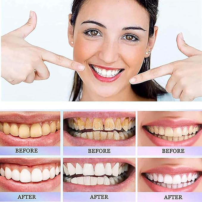 Oralhoe Nicotinamide Dazzle White Toothpaste | 100g Advanced Vitamin B3 Whitening Formula | Stain Removal, Gum Care & Fresh Breath | Sensitive Teeth Safe