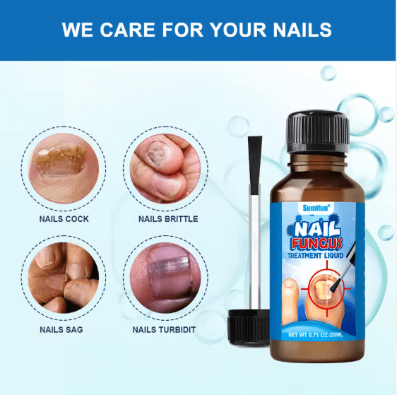 Sumifun Professional Nail Fungus Treatment & Repair Liquid | Extra Strength Antifungal Solution for Toenails & Fingernails | Restore Shine & Health (20ml) – UAE Stock