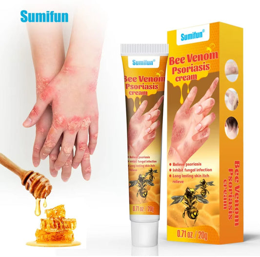 Summifun™ Bee Venom Psoriasis Cream (20g) – Fast Relief for Eczema, Itching & Dry Skin | Natural Herbal Skin Repair
